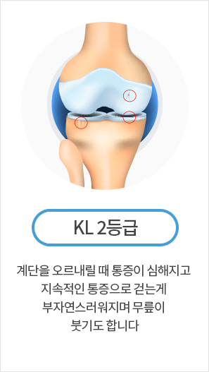 KL 2등급