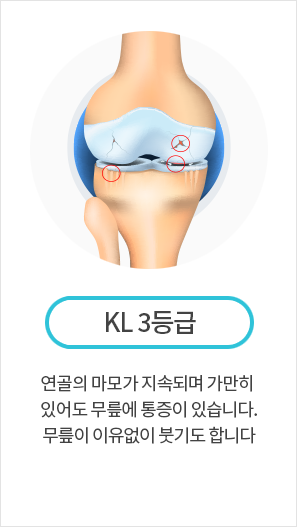 KL 3등급
