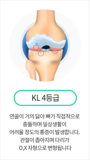 KL 4등급