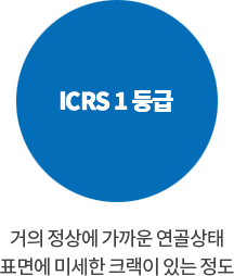 ICRS 1등급