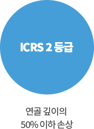 ICRS 2등급