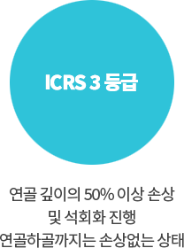 ICRS 3등급