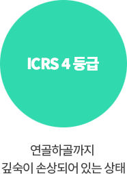 ICRS 4등급